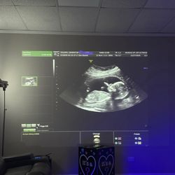Bundle of Joy Ultrasound Studio - ultrasound pic