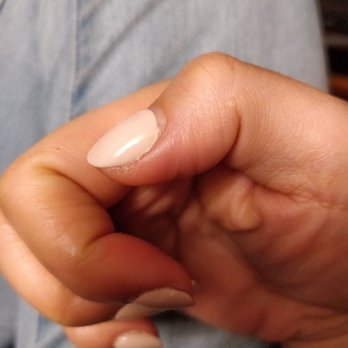 Mg Nail & Beauty - This is what happened. Cuticles were removed too much and now it's getting worse. - Nail Salons Near Me - Flushing, New York Mg Nail & Beauty - This is what happened. Cuticles were removed too much and now it's getting worse. - Nail Salons Near Me - Flushing, New York
