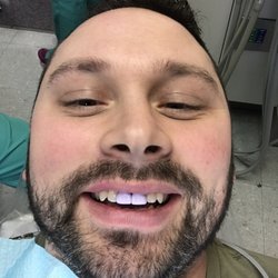 The Smile Center - Got my new front teeth and they did a great job!!!