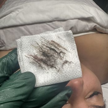 Faced Up Esthetics - Dermaplane: removal of peach fuzz and dead skin cells leaving skin with an instant glow! - Eyelash Service Near Me - Rancho Cucamonga, California