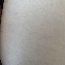 Renova Laser Hair Removal & MedSpa