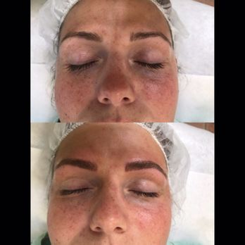 Yas Threading - Top photo is before microblading, bottom photo is after microblading - Threading Services Near Me - El Cajon, California Yas Threading - Top photo is before microblading, bottom photo is after microblading - Threading Services Near Me - El Cajon, California
