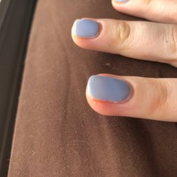 Infected fingernail