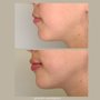 Photo of Illuminate Plastic Surgery
