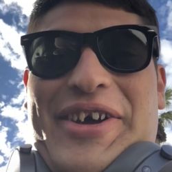 John Willardsen, DDS - Trust Implants - Meth mouth ewww