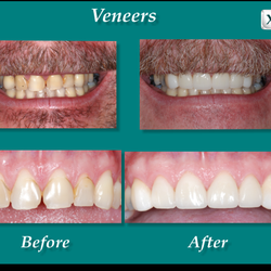 Long N Phan , DMD MAGD - TLC Dental - Veneers Murrieta, CA