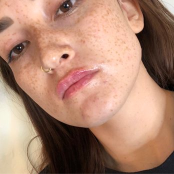 Vitality Aesthetics - lip injections - Medical Spas Near Me - San Diego, California Vitality Aesthetics - lip injections - Medical Spas Near Me - San Diego, California