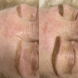 Illuminated Skincare - 4 week touchup