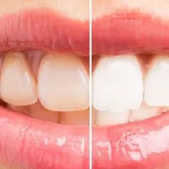 Moreschini Dental Office - General Dentistry Near Me - Pueblo, Colorado Moreschini Dental Office - General Dentistry Near Me - Pueblo, Colorado