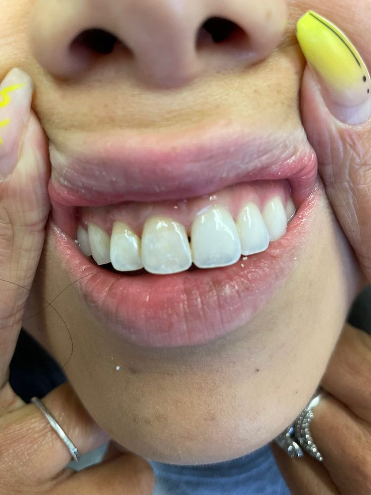 GREEN DENTAL GENERAL & COSMETIC Updated September 2024 16 Photos