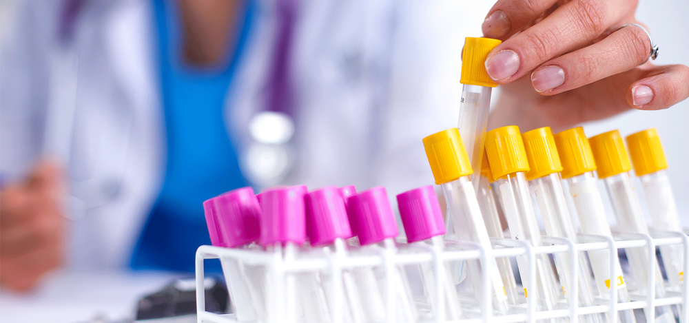 OptiVena Mobile Phlebotomy - home care agency in Queen Creek, AZ