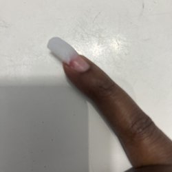 Skyline Nail and Hair Salon - My nail after Cindy tried to rip it off with her bare hands. Being lazy wanting to hury and finish didn't want to take the time to soak it.