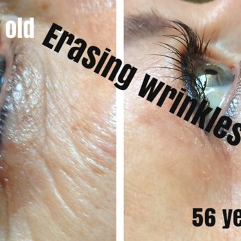 The Lovely Thorne - My clients have ask often, "is this really going to make a difference?" Good skin care regimen, chemical peels, and micro needling.YES - Permanent Makeup Near Me - Riverside, California