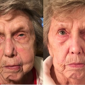 Rilassare Esthetics - Rhonda Allison products for Hyperpigmentation and Collagen Building. - Eyelash Service Near Me - Mesa, Arizona