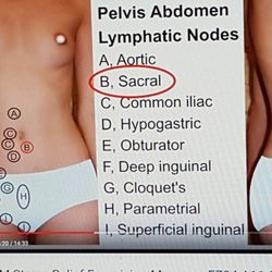 Isaac Wellness Center - Treatment part to correct posture.자세 교정을 해야 건강유지 한다. 발가락 부터 머리까지.