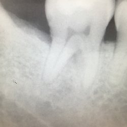 Desert View Dental - If you have to have your teeth checked in Pharump do it here!!!