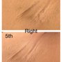 Photo of The Beautx Laser & Skin Care