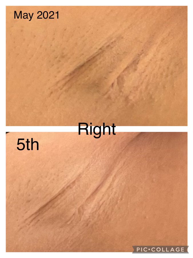 The Beautx Laser & Skin Care Logo