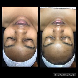 Neuskin Esthetics
