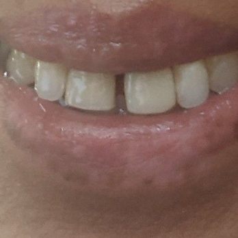 Sandaldeep Singh, DDS - Sunny Smiles Dentistry - General Dentistry Near Me - Gilroy, California Sandaldeep Singh, DDS - Sunny Smiles Dentistry - General Dentistry Near Me - Gilroy, California