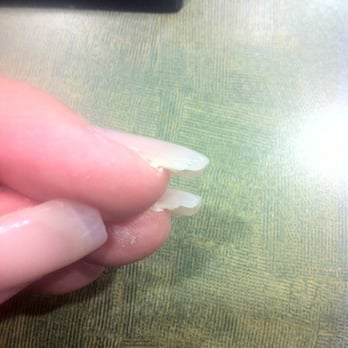 On Top Design Nail - Horrible refill and filing job. - Nail Salons Near Me - Toronto, Ontario On Top Design Nail - Horrible refill and filing job. - Nail Salons Near Me - Toronto, Ontario