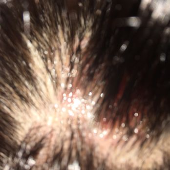 Bebe Salon - More chemical burns on my scalp - Hair Stylists Near Me - Garden Grove, California Bebe Salon - More chemical burns on my scalp - Hair Stylists Near Me - Garden Grove, California