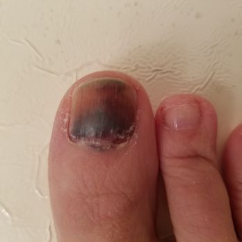 Robert Joseph, DPM - Before. - Podiatrists Near Me - Beverly Hills, California