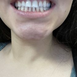 Farhad Safe, DDS - SafeDental Care - After cleaning ask for before pics he took of me, I literally was a different person all together