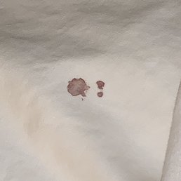 Blood on pillows Blood on pillows