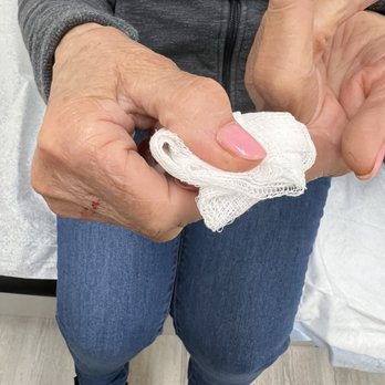 The Fast Urgent Care - Deep cut from slamming car door on her finger - Urgent Care Near Me - Brea, California The Fast Urgent Care - Deep cut from slamming car door on her finger - Urgent Care Near Me - Brea, California