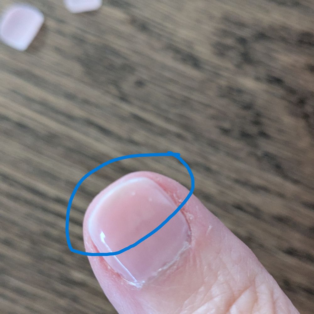 air pockets under nail