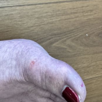 Bliss Nails & Spa - Cuts to right foots & gouged toe nails - Nail Salons Near Me - Mequon, Wisconsin