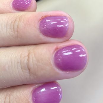 ProfessioNail - Cuticle injuries on two of three fingers that were nicked - Nail Salons Near Me - San Diego, California ProfessioNail - Cuticle injuries on two of three fingers that were nicked - Nail Salons Near Me - San Diego, California