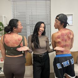 Magnolia Wellness - Cupping