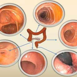 Muhammad Y Sheikh, MD - "COLONOSCOPY IN FRESNO" https://www.facebook.com/colonoscopy.fresno/