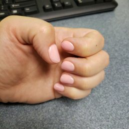 Chip on thumb with lines from where the polish snapped Chip on thumb with lines from where the polish snapped