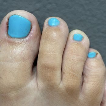 Nail C Beauty Salon - Painful, bloody toes - Nail Salons Near Me - Kent, Washington