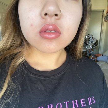 Kissd By Kim - Day 1 : swollen, post-procedure - Permanent Makeup Near Me - Orange, California Kissd By Kim - Day 1 : swollen, post-procedure - Permanent Makeup Near Me - Orange, California