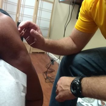 Michael A Selvitella, DC - Needles in! - Chiropractors Near Me - Streamwood, Illinois
