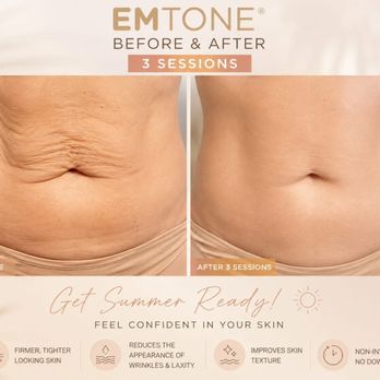 Balanced Body Spa - Summer coming, EMTONE for skin looking good. - Skin Care Near Me - Los Angeles, California Balanced Body Spa - Summer coming, EMTONE for skin looking good. - Skin Care Near Me - Los Angeles, California