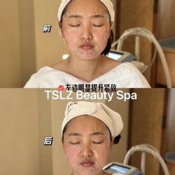 TSLZ Beauty Spa