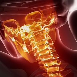 Joseph Arevalo, DC - Neck pain relief.