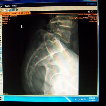 UP Health System - Portage - image from 7/12/2019 Ct Cr sitting aspirus - Hospitals Near Me - Hancock, Michigan UP Health System - Portage - image from 7/12/2019 Ct Cr sitting aspirus - Hospitals Near Me - Hancock, Michigan