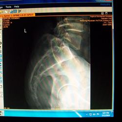 UP Health System - Portage - Image from 7/12/2019 Ct Cr sitting aspirus