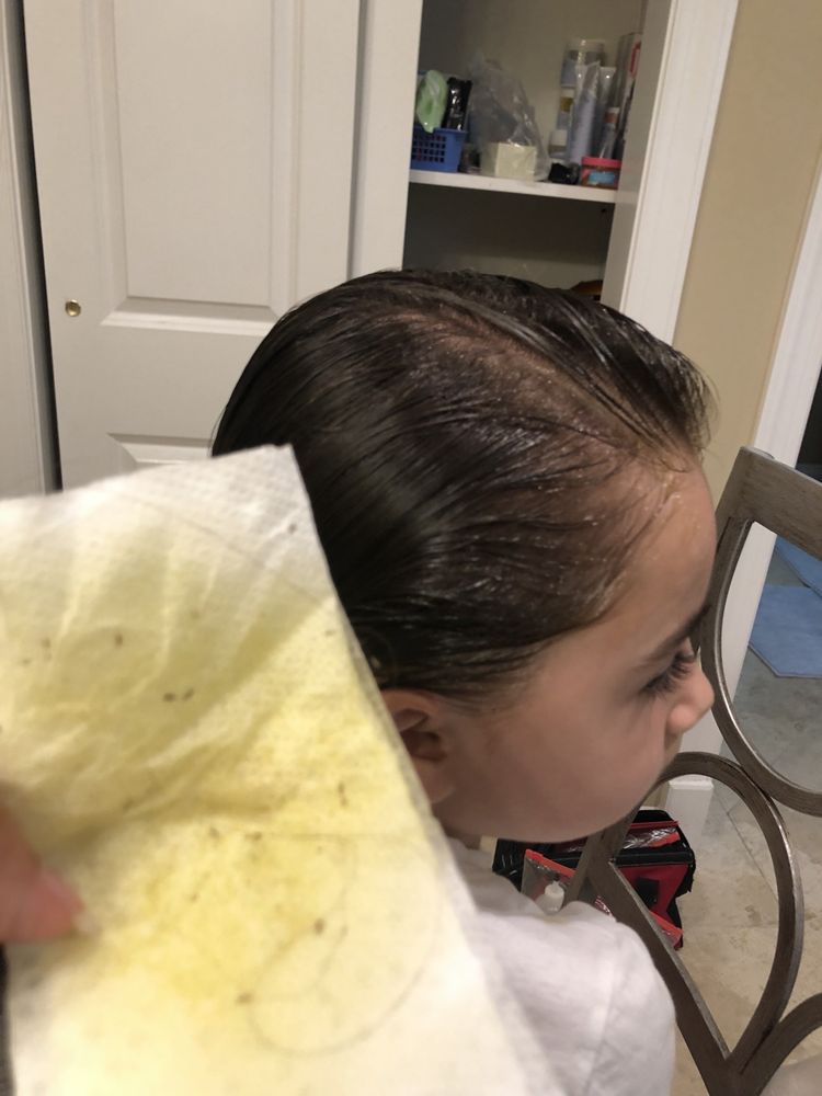 LICE REMOVAL New Brunswick, NJ Yelp