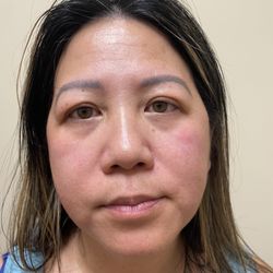 20/20 Image Optometry - After