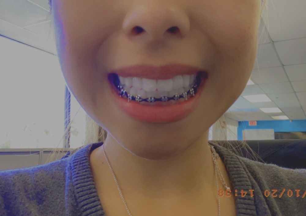 PREMIER BRACES Updated October 2024 36 Reviews 9225 Mira Mesa