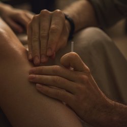 Resonant Body Acupuncture