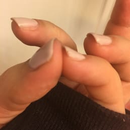 See the bumps and missing sides
