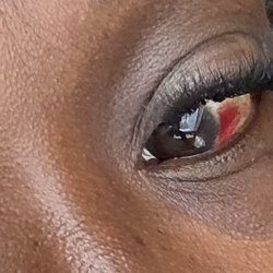 Pearlbrows & Lash Studio - My eye injury after lash extensions